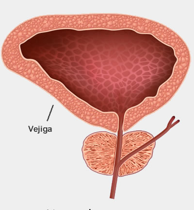 Vejiga